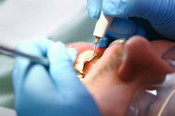 Best Walk-In Emergency Dentist in Ridgway, PA
