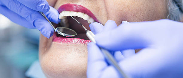 Best Emergency Tooth Extraction in Ridgway, PA